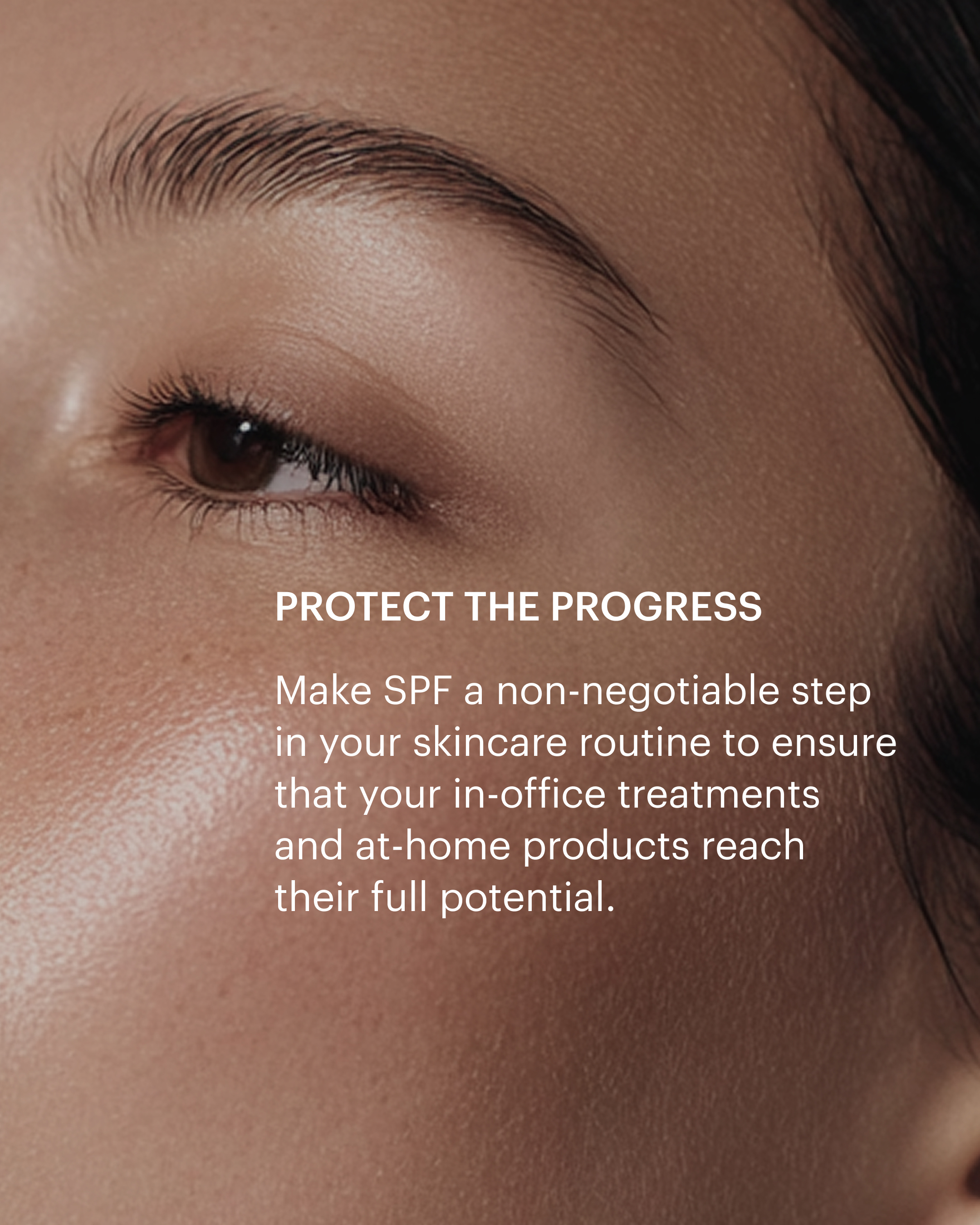 Allē – Spring Cleaning Skincare – In-Feed Social Post - Allergan Brandbox